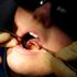 NHS dental patients 'face two-year wait and private charges for treatment', says watchdog
