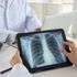 Lung cancer referrals drop by more than 20,000 during COVID pandemic