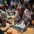 ‘Stain on our conscience’: UN warns of urgent crisis in Ethiopia as children face starvation