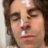 Liam Gallagher ‘fell out the helicopter’ after Isle Of Wight Festival