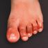 ‘COVID toes’ may be side effect of body fighting virus, study finds